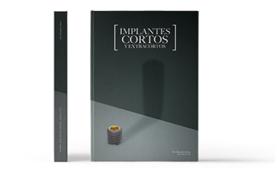 Short Implants, new book by Dr. Eduardo Anitua